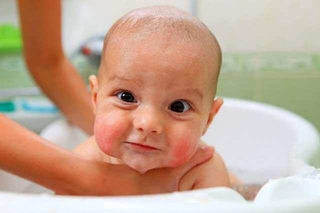 Bébé dans le bain, le moment idéal pour traiter la dermatite atopique