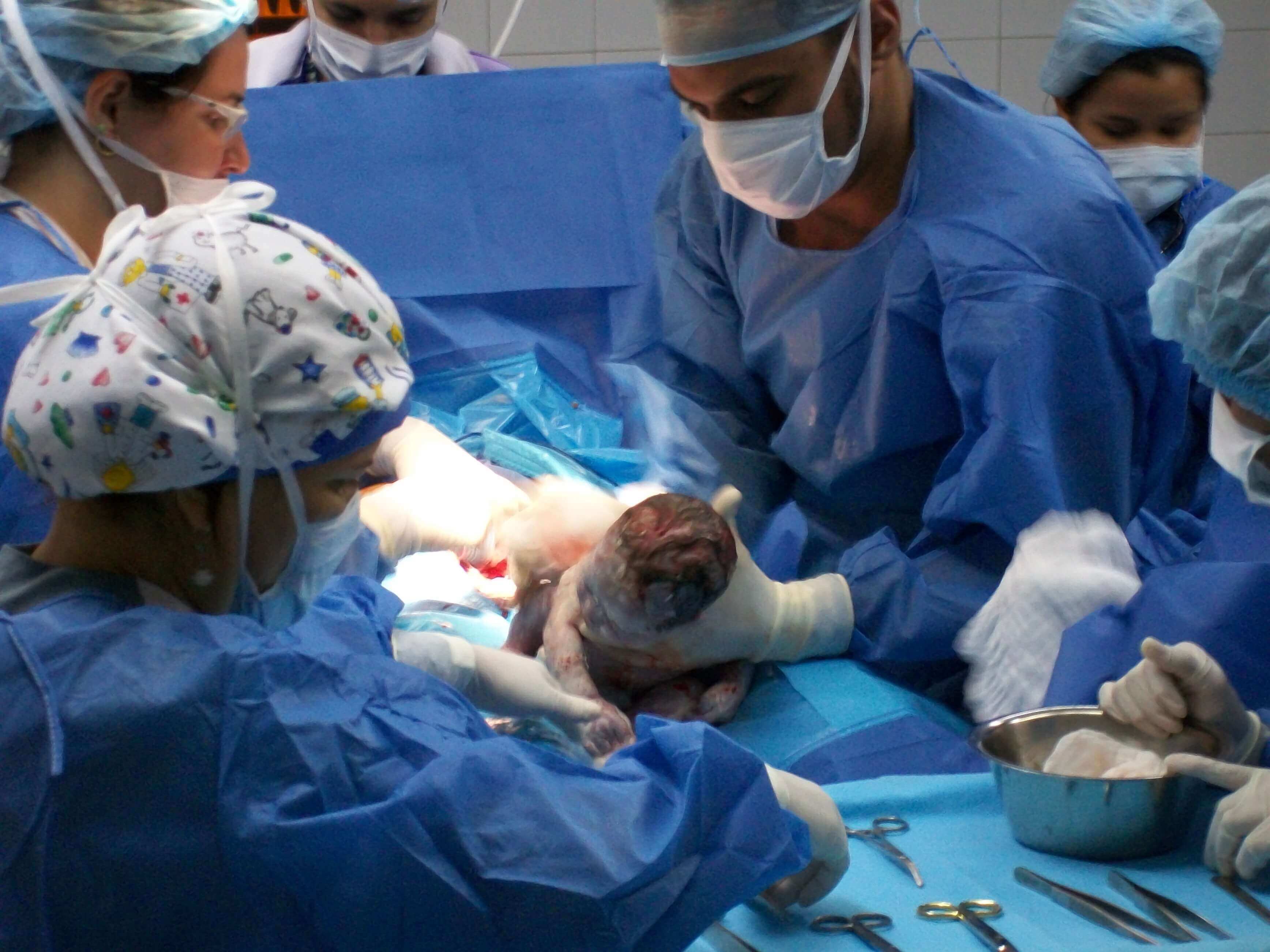 Les étapes de l'accouchement