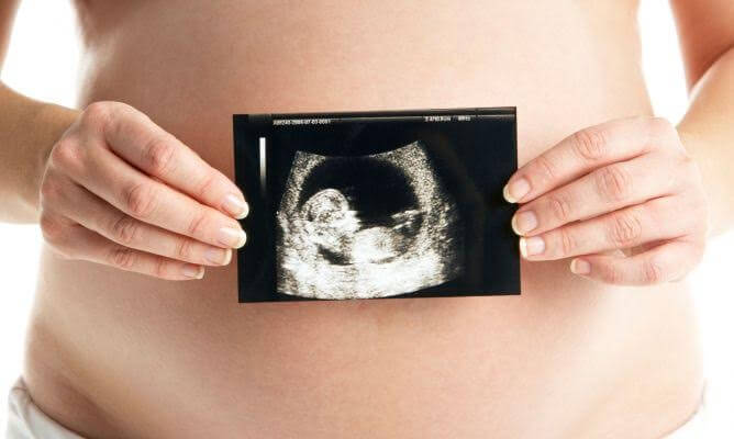 Maman enceinte avec une échographie dans les mains, qui peut permettre d'identifier la lyse d'un jumeau