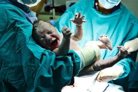 Être né par césarienne peut-il nuire à la santé du bébé ?