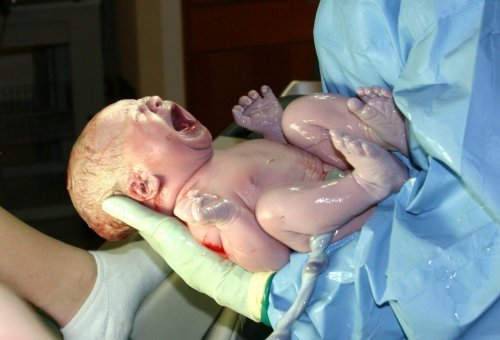 Connaissez-vous les 9 types d’accouchement ?