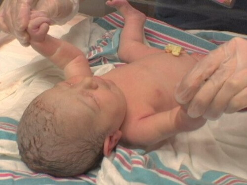 Un nouveau-né passe le test d'Apgar après la naissance