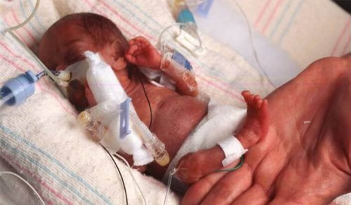 Il existe même des bébés prématurés qui naissent entre la semaine 20 et la semaine 22