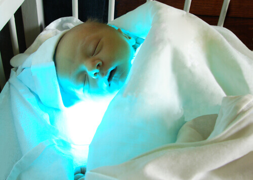 La jaunisse infantile