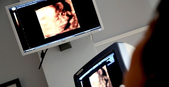 Les signaux de souffrance fœtale peuvent être observés dès le premier trimestre de grossesse 