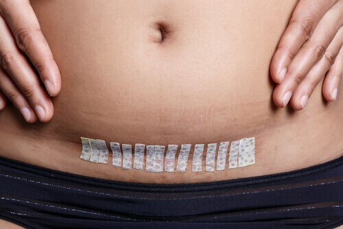 Être mère après une hystérectomie