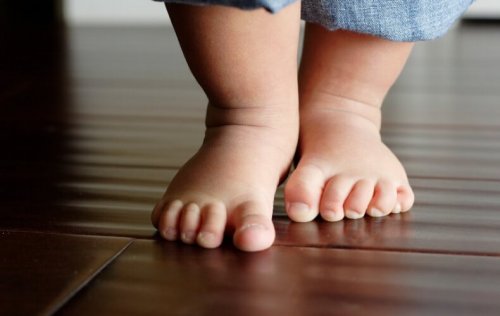 bambin aux jambes arquées