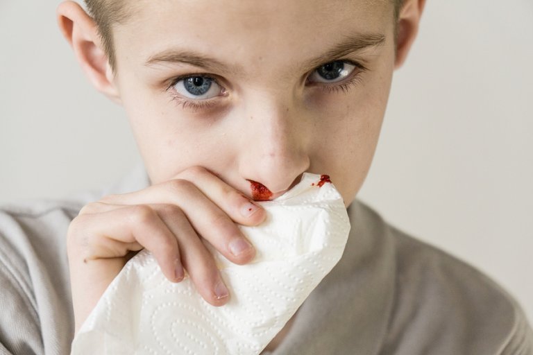 Pourquoi mon enfant saigne du nez ?