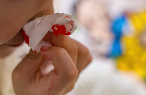 Les saignements de nez chez les enfants