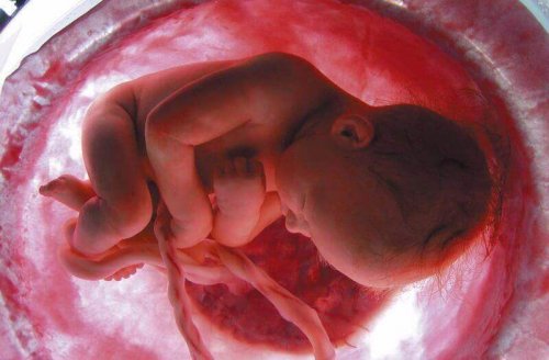 cordon ombilical enroulé autour du bébé