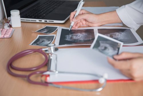 l'échographie détecte une superfécondation
