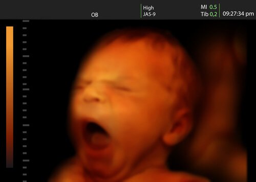 Au cours de la semaine 22 de la grossesse, le bébé commence à développer son système limbique et ressentir des émotions et des sentiments.