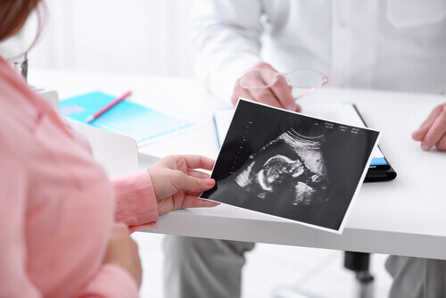 Avant d'effectuer un accouchement par le siège, on peut réaliser une manœuvre nommée "version céphalique externe" qui vise à retourner le bébé dans le ventre.