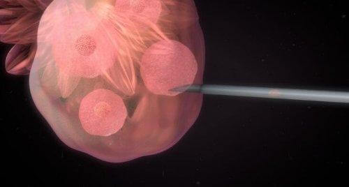 L'insémination artificielle : en quoi ça consiste ?