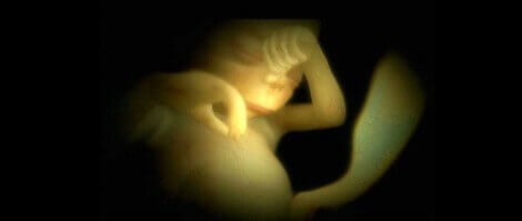 Lors de la semaine 24 de la grossesse, le fœtus n'arrête pas de bouger, il a encore beaucoup de place dans le liquide amniotique. 
