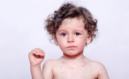 Les causes de l' allergie à la sueur chez les enfants