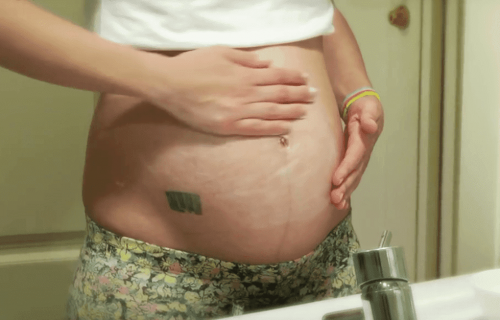La ligne blanche qui traverse l'abdomen