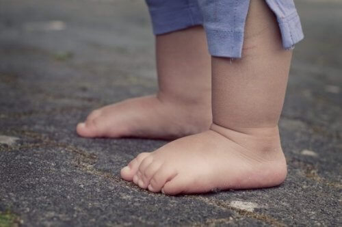 L'achondroplasie chez l'enfant