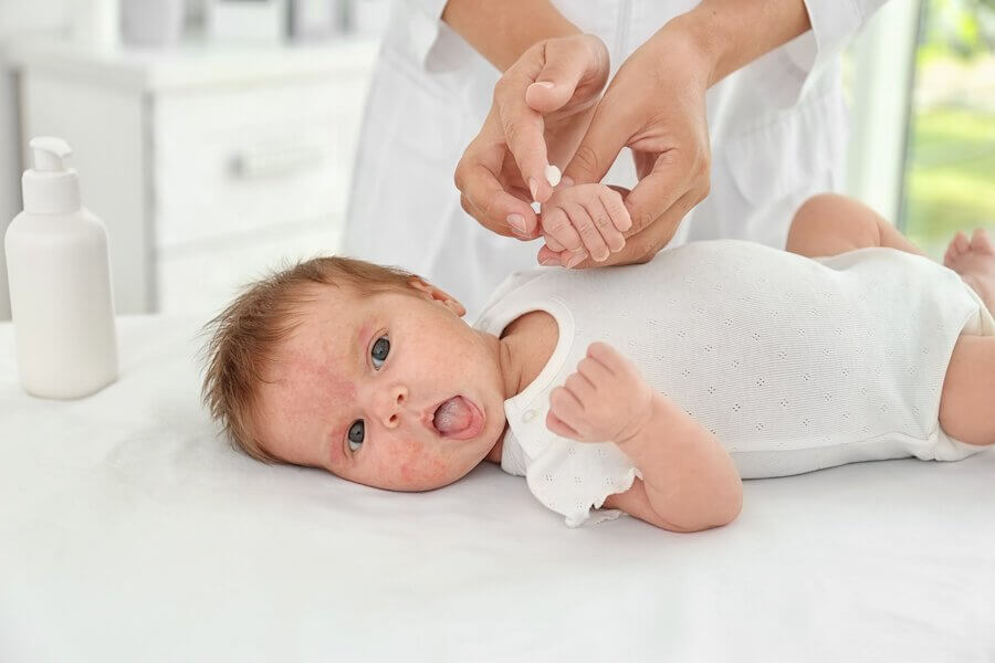 Pour prévenir la dermatite atopique, il est important d'habiller le bébé ou l'enfant avec des vêtements sans tissus synthétiques.