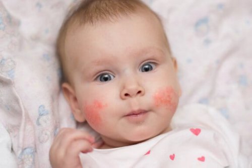 Mon Enfant A Des Mycoses Sous Les Pieds Que Faire Etre Parents