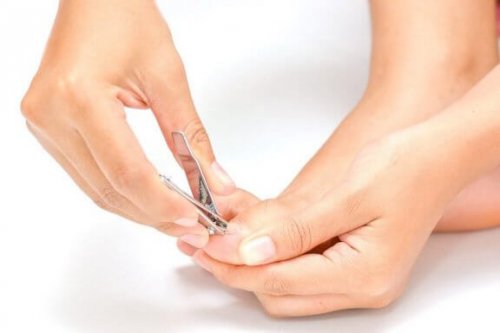 Comment soigner les ongles incarnés ?