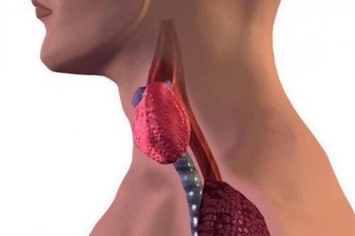 Thyroïdite de Hashimoto chez l'enfant