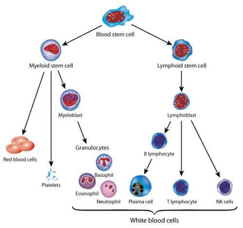 Schéma explicatif des différents types de leucémie