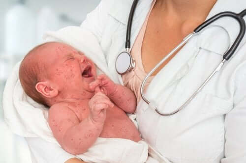 Un bébé qui a la rougeole