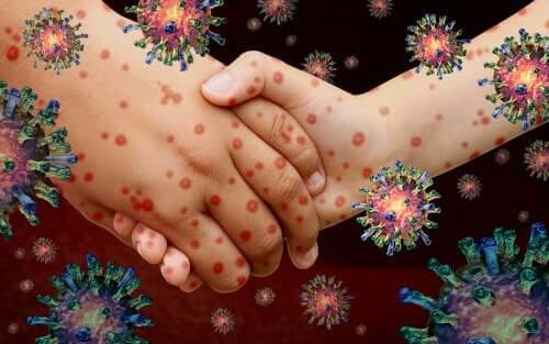 La contagion de la rougeole passe par le contact physique direct