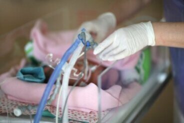 Le syndrome de détresse respiratoire chez le nouveau-né