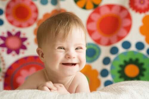 Les bébés atteints du syndrome de Down et l'allaitement