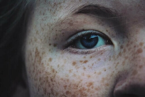 Les taches de rousseur et les grains de beauté