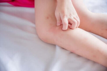 Allergie au latex chez les enfants