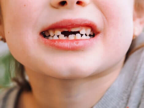 La bouche d'un enfant avec des dents de lait.