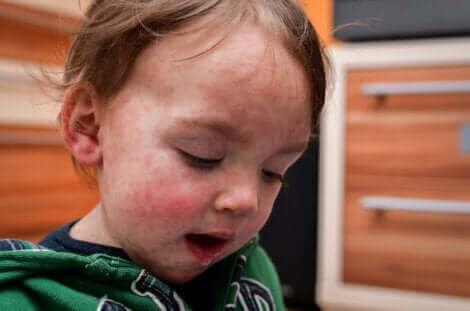 Un enfant avec des marques sur le visage.
