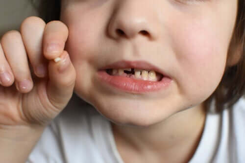 Chocs sur les dents de lait, que faire ?