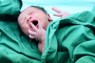Le sepsis néonatal : causes et séquelles