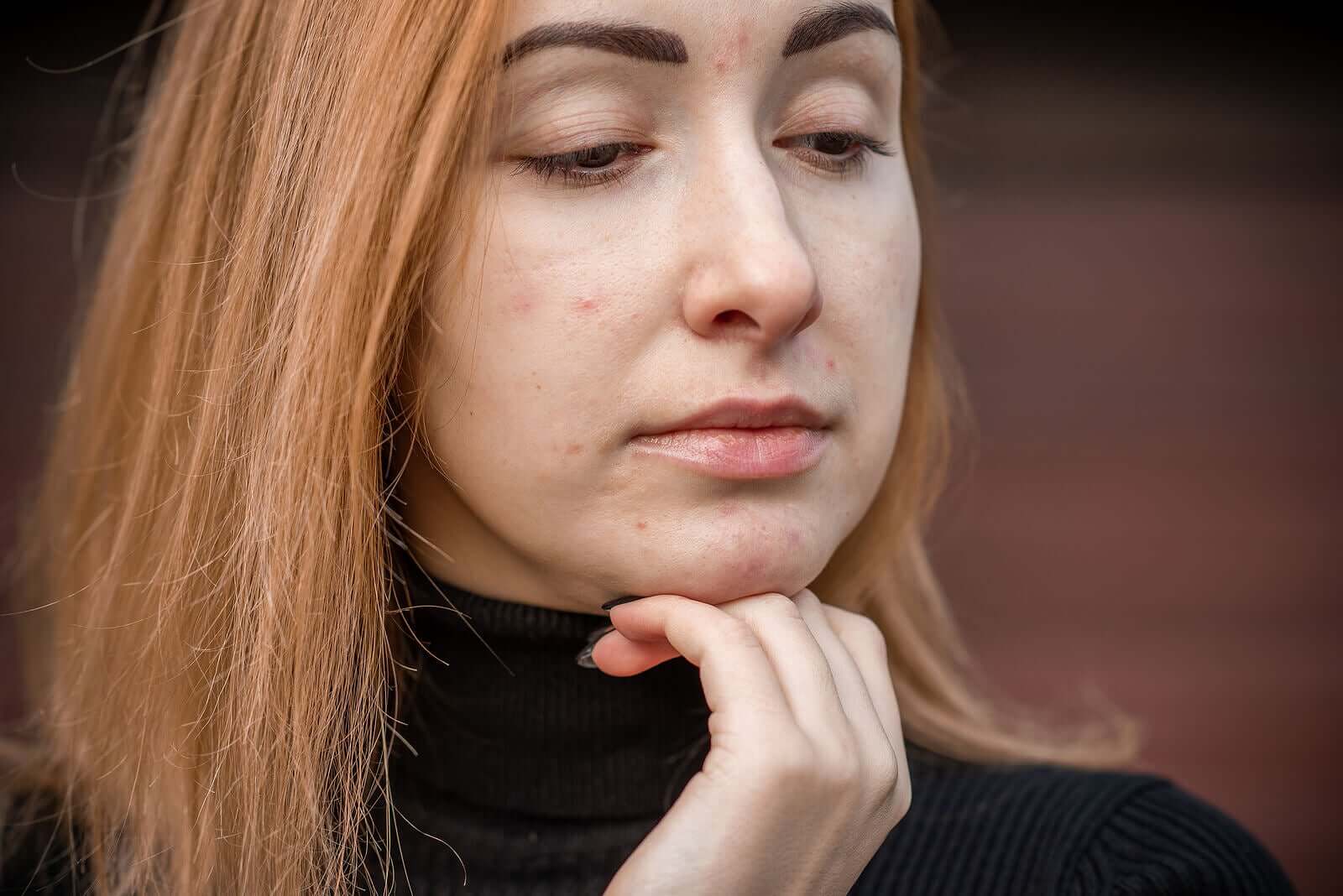 Une femme souffrant d'acné juvénile.