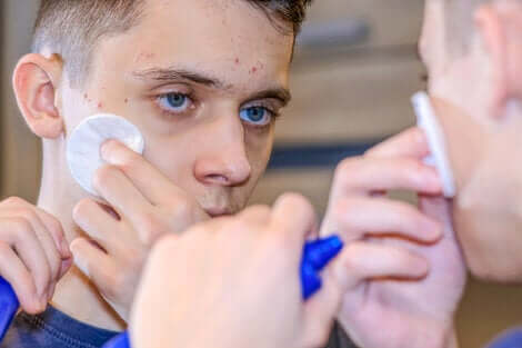 Un adolescent qui s'applique un traitement sur la peau.