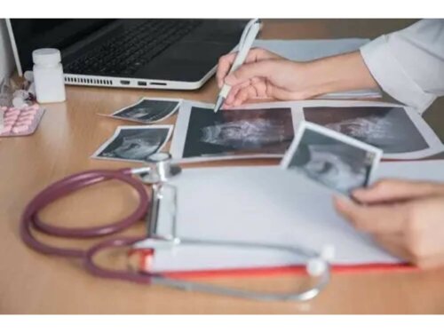 Une échographie 5D.