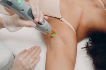 Épilation au laser chez les adolescents: tout ce que vous devez savoir