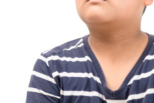 Acanthose pigmentaire chez les enfants: causes et traitement