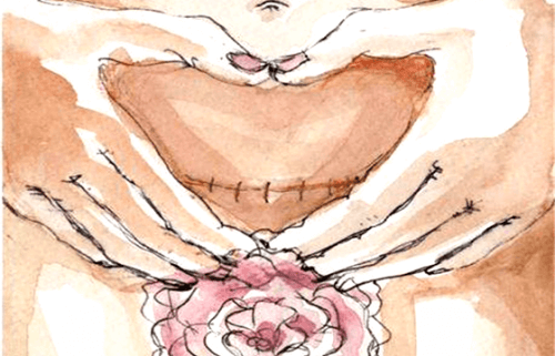 Naître par césarienne est aussi une façon « sacrée » d'arriver dans le monde