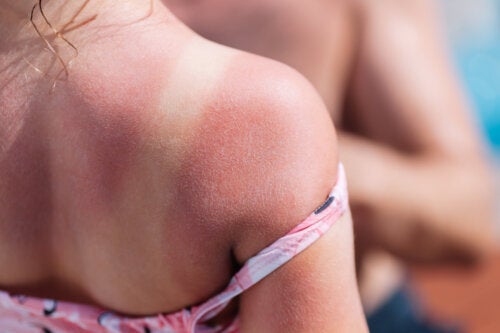 Pourquoi les coups de soleil sont-ils si dangereux chez les enfants?