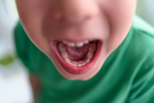 Double rangée de dents chez les enfants: que faire?