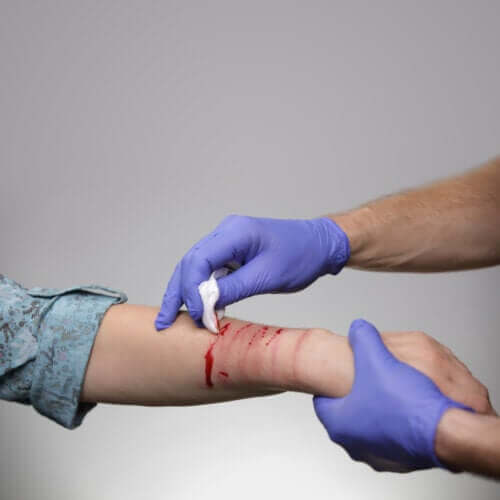 Scarification à l'adolescence : ce qu'il faut savoir