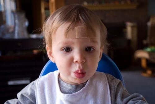 Astuces pour cacher les cicatrices des enfants