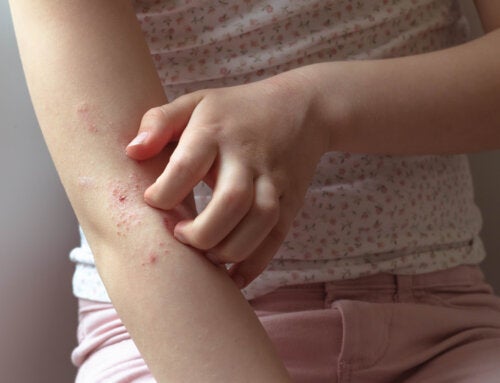 Comment éviter les démangeaisons de la peau atopique?