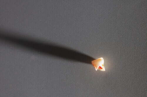 Perte prématurée d'une dent de lait : causes et conséquences