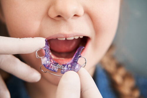 Quand commencer l'orthodontie ?